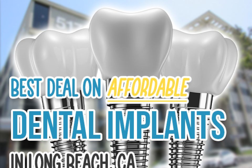 Best Deal on Affordable Dental Implants in Long Beach